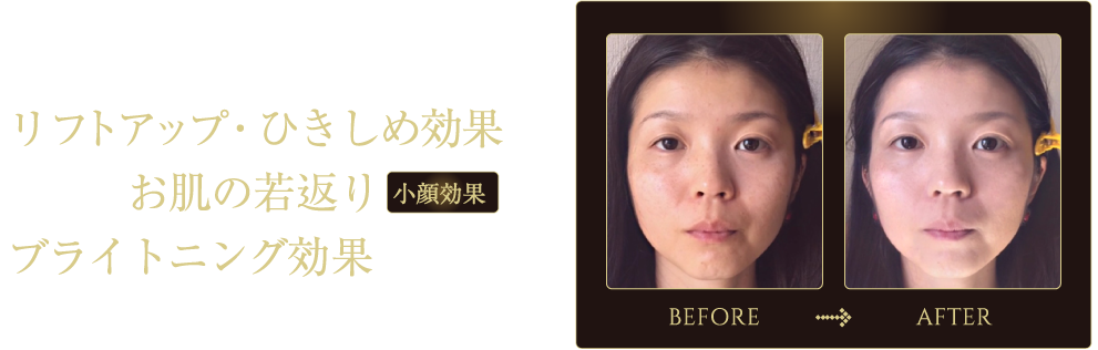 BEFORE／AFTER 